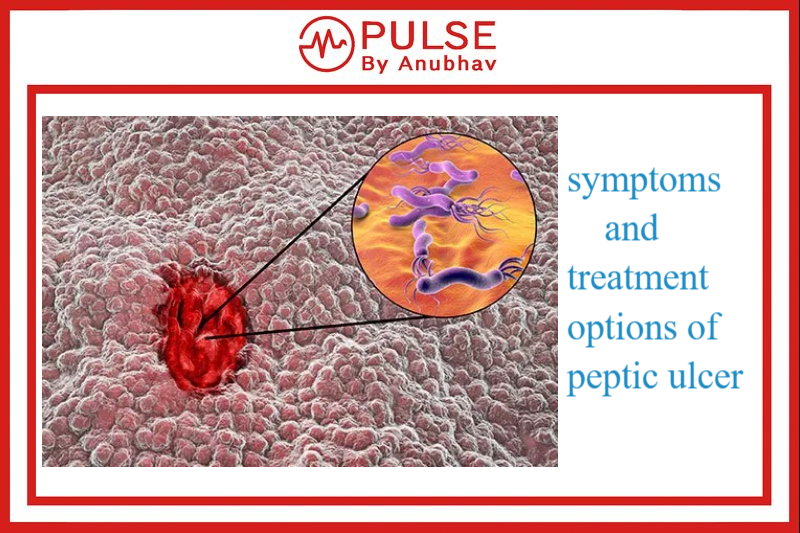 Peptic ulcer treatment Peptic ulcer symptoms Peptic ulcer causes Peptic ulcer ppt Peptic ulcer vs gastric ulcer Peptic ulcer symptoms female Types of peptic ulcer Peptic ulcer pathophysiology