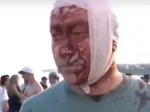 australia attack bondi beach