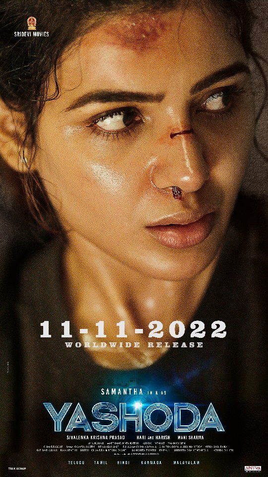 samantha birthday date
samantha birthday age
samantha ruth prabhu birthday wishes
samantha birthday celebration photos
rakul preet singh samantha birthday wish
nayanthara wish for samantha birthday
samantha birthday news
samantha ruth prabhu age and biography
samantha upcoming movies 2026
samantha health myositis update
samantha and naga chaitanya relationship
samantha net worth 2026
samantha popular movies list
samantha inspirational quotes
samantha latest news today
Samantha Ruth Prabhu biography
Samantha ruth prabhu Instagram
Samantha Ruth Prabhu Movies
Samantha Ruth Prabhu new Movie
Samantha Ruth Prabhu husband
Samantha Ruth Prabhu height
Samantha Ruth Prabhu photos
Samantha Ruth Prabhu age
samantha
samantha birthday