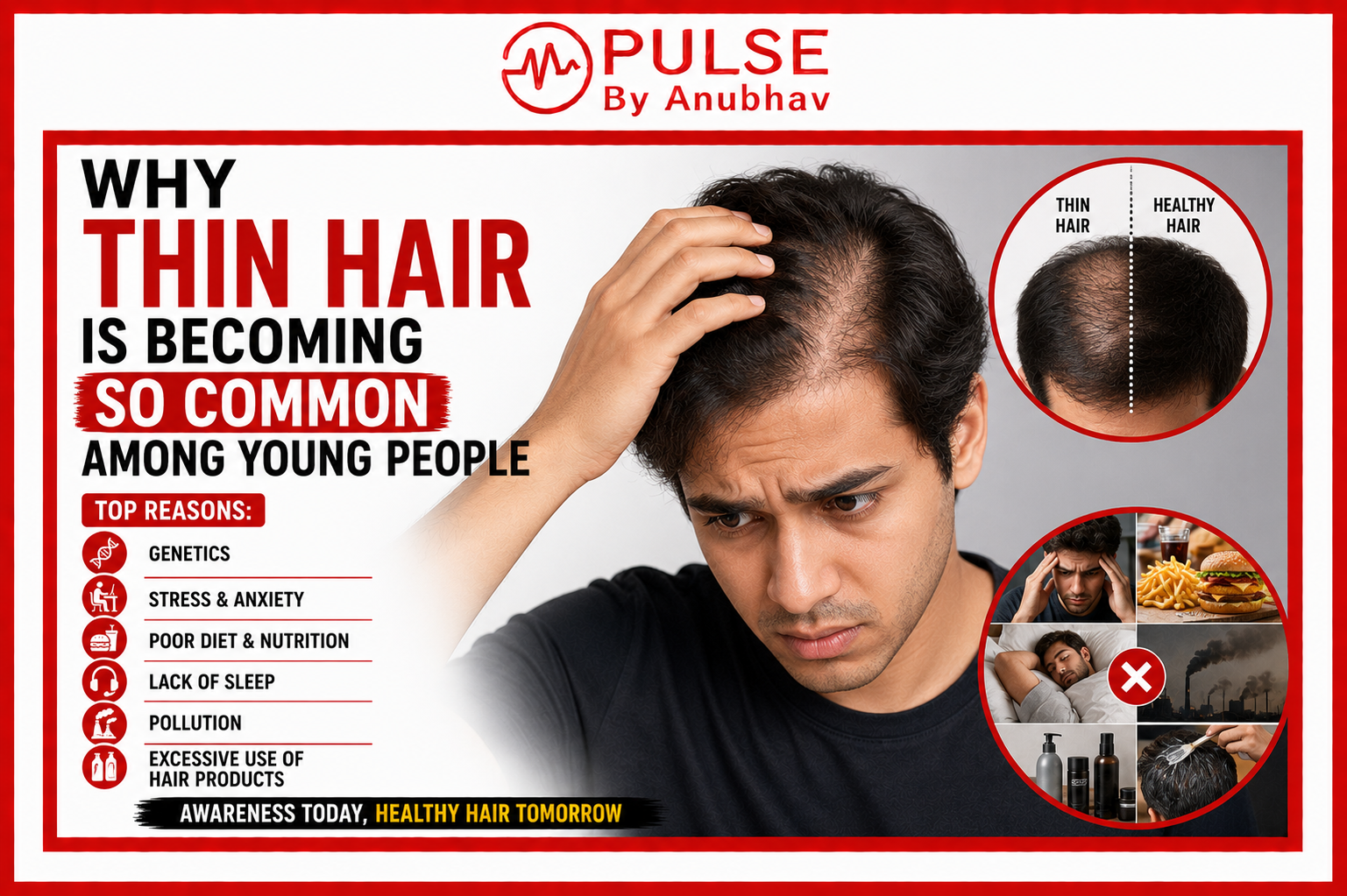 Why is my teen daughter's hair falling out 5 year old hair thinning How to treat hair loss due to hypothyroidism Hashimoto hair loss remedy Losing hair at 18 Lupus hair loss pattern How to stop hair loss with Graves' disease Toddler hair thinning on top Thin Hair Causes in Young Adults Why Is My Hair Getting Thinner How to Fix Thin Hair Naturally Best Foods for Thin Hair Growth Thin Hair Treatment at Home Stress and Hair Thinning Connection Signs of Hair Thinning in Women Signs of Hair Thinning in Men How to Increase Hair Density Naturally Best Vitamins for Thin Hair Can Lack of Sleep Cause Hair Loss Thin Hair vs Hair Loss Difference How to Make Thin Hair Look Thicker Hormonal Causes of Thin Hair Protein Deficiency and Hair Thinning Pollution Effects on Hair Health Best Hair Care Routine for Thin Hair Can Hard Water Cause Thin Hair Natural Remedies for Thin Hair How to Prevent Hair Thinning Early
