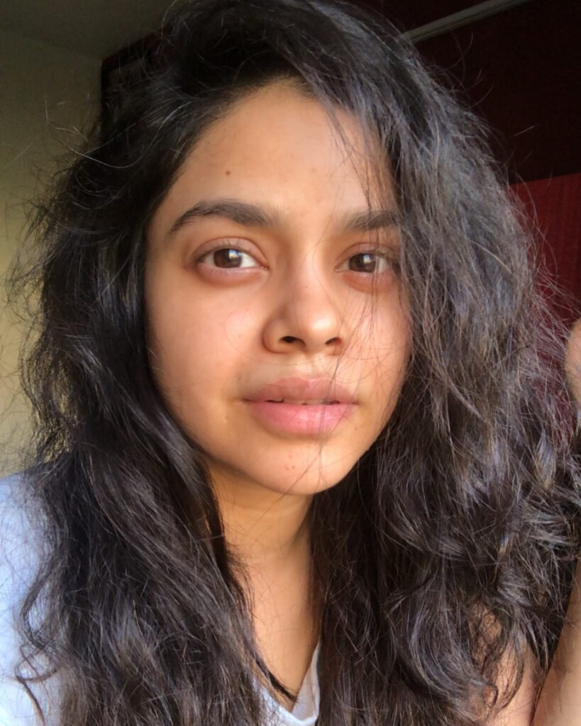 Sumona Chakravarti Endometriosis Surgery
Sumona Chakravarti Health Update
Sumona Chakravarti Biography
Sumona Chakravarti Age
Sumona Chakravarti Height
Sumona Chakravarti Boyfriend
Sumona Chakravarti Husband
Sumona Chakravarti Family
Sumona Chakravarti Parents
Sumona Chakravarti Net Worth
Sumona Chakravarti Instagram
Sumona Chakravarti Movies and TV Shows
Sumona Chakravarti The Kapil Sharma Show
Sumona Chakravarti Stage IV Endometriosis
Sumona Chakravarti Recovery Story
Sumona Chakravarti Latest News
Sumona Chakravarti Surgery Scars
Sumona Chakravarti Career
Sumona Chakravarti Worklist
Sumona Chakravarti Lifestyle
Sumona Chakravarti Education
Sumona Chakravarti Awards
Sumona Chakravarti Barfi Movie
Sumona Chakravarti Kick Movie
Sumona Chakravarti News Today
