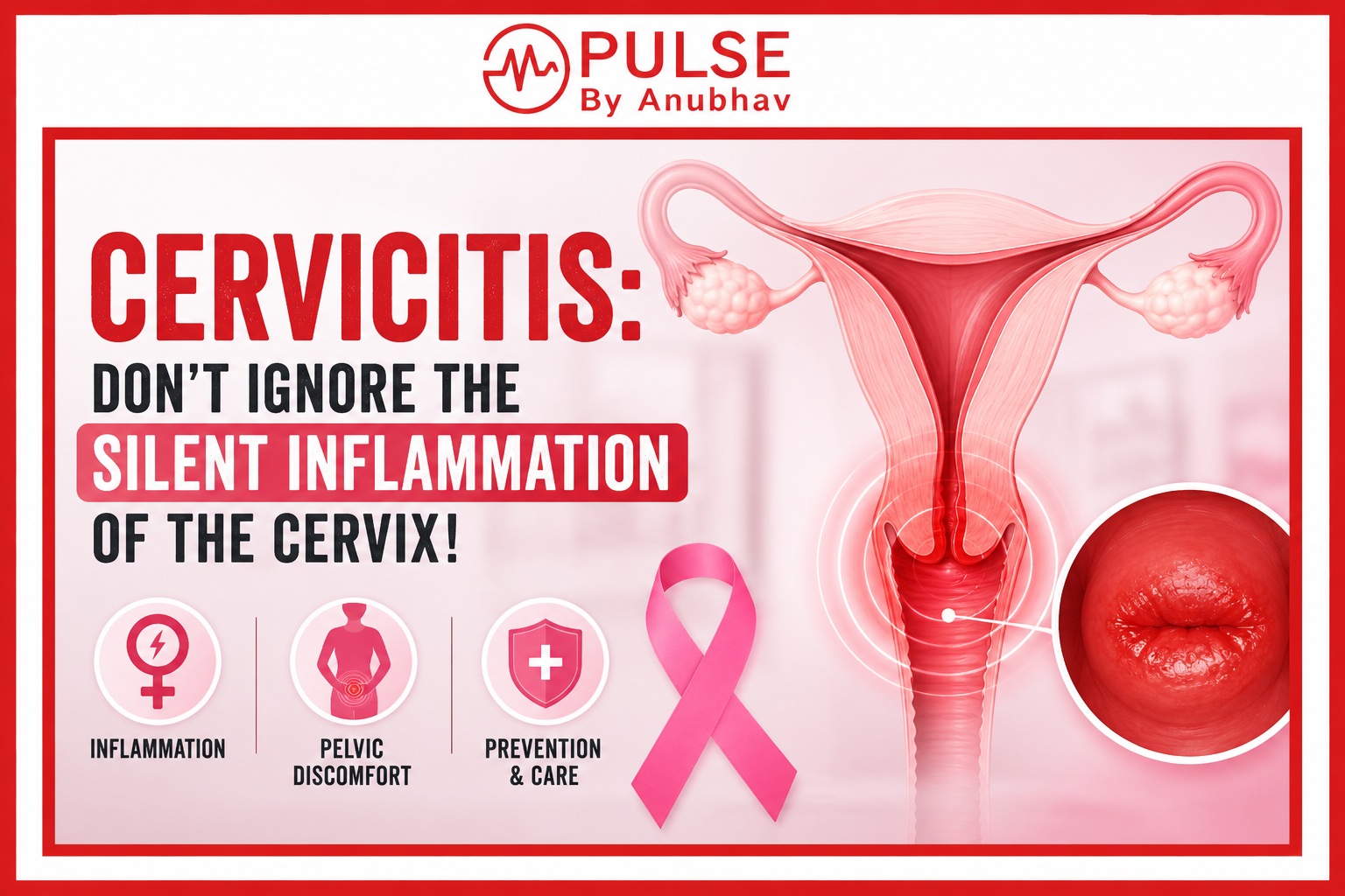 Cervicitis treatment Cervicitis treatment at home Cervicitis symptoms Cervicitis treatment guidelines Chronic cervicitis treatment Cervicitis treatment kit Cervicitis causes Cervicitis treatment antibiotics dosage
